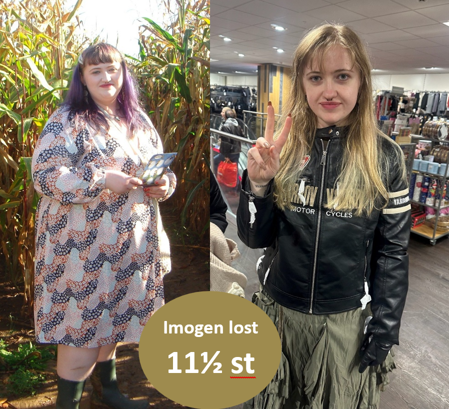 Imogen before and after